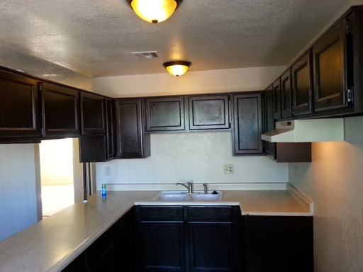 bel2159 (NLV-W)(PRB)